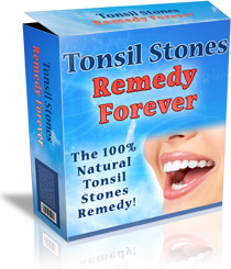 Tonsil Stones Remedy Forever™