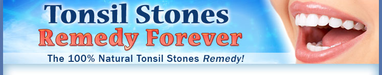 Tonsil Stones Free Forever